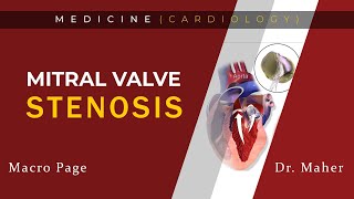 Mitral Stenosis findings  Valvular Heart Disease 2  With mnemonics [upl. by Srednas]