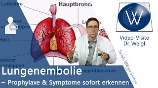 Lungenembolie ⚠ unbedingt vorbeugen amp schnell erkennen  Symptome Behandlung amp Ursachen erklärt ✅ [upl. by Beane]