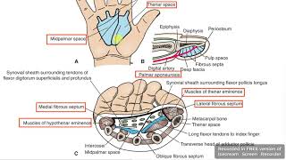 Palm fascial spaces 1 [upl. by Amalburga]