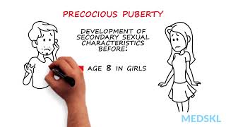 Pediatrics – Abnormal Pubertal Development By Paola Luca MD [upl. by Vedis]