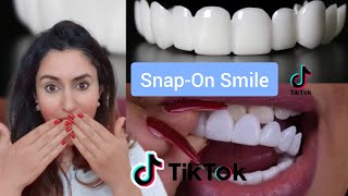 Orthodontist Reacts To SnapOn Veneer TikToks [upl. by Kettie]