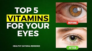 Top 5 Vitamins For Your Eyes [upl. by Allemrac482]