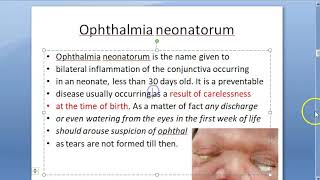 Ophthalmology Neonatal Conjunctivitis Ophthalmia Neonatorum Causes Eye Discharge in Baby Newborn [upl. by Amaty87]