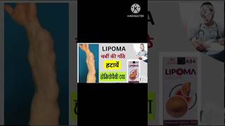 Lipoma A84 drop Allen  Homeopathic Treatment for Lipoma  Without surgery  Tumor GlandFatty Gath [upl. by Ihab]