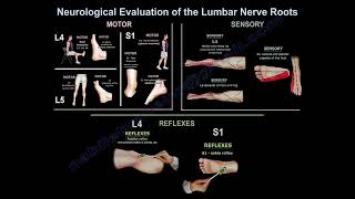 Neurological Evaluation Of The Lumbar Nerve Roots how do you diagnose the affected nerve [upl. by Crocker]