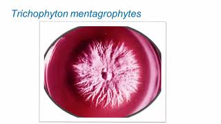 Superficial Fungal Infections Dermatophytes Part 2 Hot Topic [upl. by Gianina]