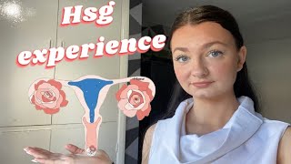 MY HSG EXPERIENCE  POSITIVE [upl. by Annatnom741]