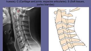 Anatomia radiologica de la columna vertebral [upl. by Casmey103]