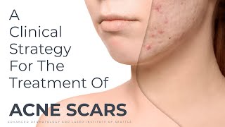 A Clinical Strategy For The Treatment Of Acne Scars [upl. by Raye670]