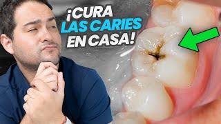 LA VERDAD SOBRE LA CARIES DENTAL ¿Como curarla en casa [upl. by Htyderem121]