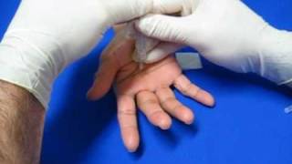 Hand Injection Techniques  Trigger Finger [upl. by Haisej]