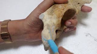 Ischial tuberosity of hip bone [upl. by Patten541]