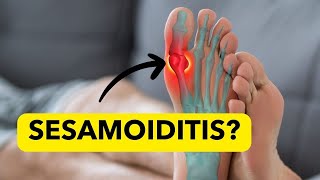 SesamoiditisHome Remedies What is It Pain at the base of Big Toe [upl. by Aklam385]