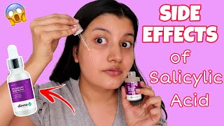 SIDE EFFECTS of Salicylic Acid  Is Salicylic Acid Safe To Use For ACNE amp PIMPLES [upl. by Otiragram473]