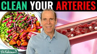 Can a Nutritarian Diet Remove Calcified Plaque in Arteries  Dr Joel Fuhrman [upl. by Bucky]