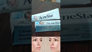 acnestar gel review  acnestar gel kaise use kare youtubeshorts shortsvideo shorts ytshorts [upl. by Kurys]