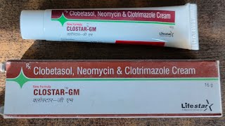 clotrimazole cream review in Hindi  ClostarGM cream [upl. by Enilrac]