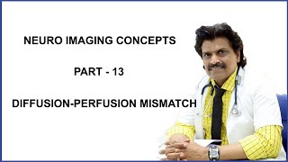 NEURO IMAGING CONCEPTS PART  13 DIFFUSION PERFUSION MISMATCH [upl. by Siusan607]