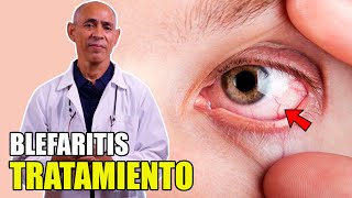 👀 BLEFARITIS Tratamiento Párpados hinchados por uso de PANTALLAS 📵 [upl. by Obmar425]