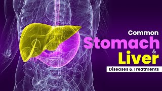 Common Stomach and Liver Diseases and Treatment Hindi  Dr Manoj Kumar Gastroenterology [upl. by Ahseya]