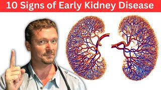 10 Signs of Early Kidney Disease amp Kidney Labs You Need [upl. by Mulligan]