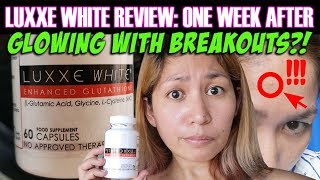 Luxxe White Glutathione 2019 Review One Week After Dami Breakouts Itutuloy ko pa ba [upl. by Ayanaj517]