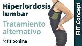 Hiperlordosis lumbar  Visión desde la fisioterapia y la medicina natural [upl. by Twum]