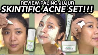 REVIEW JUJUR ACNE SET SKINTIFIC  OBAT JERAWAT UNTUK JERAWAT YANG TUMBUH TERUS TERUSAN [upl. by Longo]