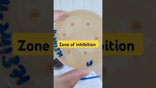 Antibiotics sensitive test zone of inhibition Antibiotics shorts [upl. by Maureen]