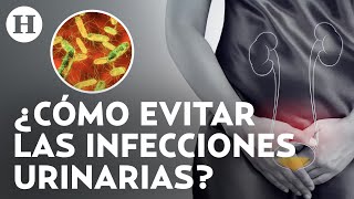 ¡Nunca te aguantes las ganas de ir a orinar Especialista alerta de infecciones en vías urinarias [upl. by Freddie650]