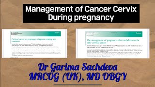 Cancer cervix during pregnancy Management [upl. by Lexine]