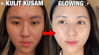 5 CARA AMPUH Untuk KULIT CERAH amp GLOWING✨  Dari Kusam jadi Glowing 🌟 [upl. by Limay]