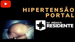 Hipertensão Portal para Residência Médica [upl. by Aneekahs]