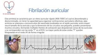 Aspectos electrocardiográficos de las arritmias supraventriculares [upl. by Donata]