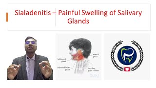 Dr Rudra Mohan  Sialadenitis  Painful Inflammatory Swelling of Salivary Glands [upl. by Sedlik]