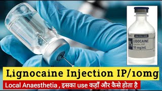 lignocaine hydrochloride injection use  lignocaine and adrenaline injection  Local Anesthetics [upl. by Nycila]