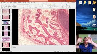 Histology of the Ossification part 1 [upl. by Enwad]