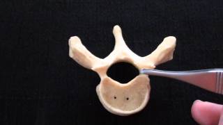 Typical Vertebra  Spinal column  Anatomy [upl. by Jobye823]