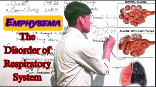 Emphysema  The disorder of Respiratory System Class 10th Biology [upl. by Nettie780]