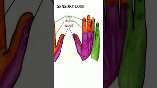 Sensory loss viralshort allaboutnorcet biology bscnursing bscnursing1styear medicaleducation [upl. by Eidoow]