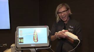 Scanning for a SingleUnit Crown with the iTero Element® 2 Intraoral Scanner [upl. by Sanderson]