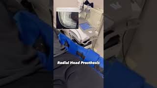 🦾 Radial head prosthesis with Winback Therapy 👏 physio rehabilitation [upl. by Krigsman]