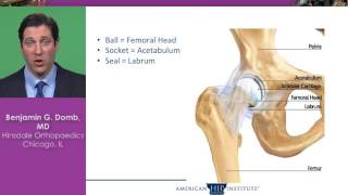 Hip Arthroscopy [upl. by Robaina]