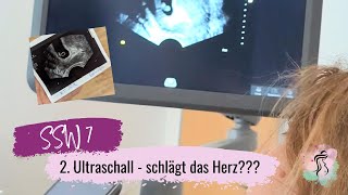 SSW 7  2Ultraschall  Schlägt das Herz 🥹  Mädchen oder Junge Ramzi Methode [upl. by Carmela889]