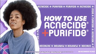 Get started with Acnecide benzoyl peroxide spot treatment What you need to know [upl. by Guillemette882]