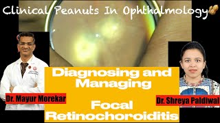 Toxoplasma RetinochoroiditisCase discussion for Ophthalmologists Residents trainees and students [upl. by Adara]