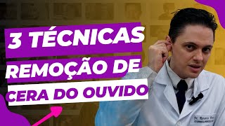 🔥Como é a remoção de cera do ouvido no Consultório Otorrino explica [upl. by Dnalhsa]