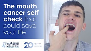 How to do a mouth cancer check at home [upl. by Bergeron]