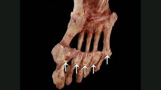 Revisión de los huesos las articulaciones y los ligamentos del pie [upl. by Nomla]