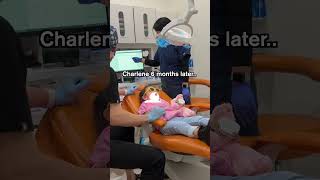 Highly observant child remembers instructions TOO well 😂 Pediatric Dentist [upl. by Ettenej107]